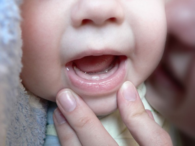 Жёлтые зубы у грудничка: что это может быть?