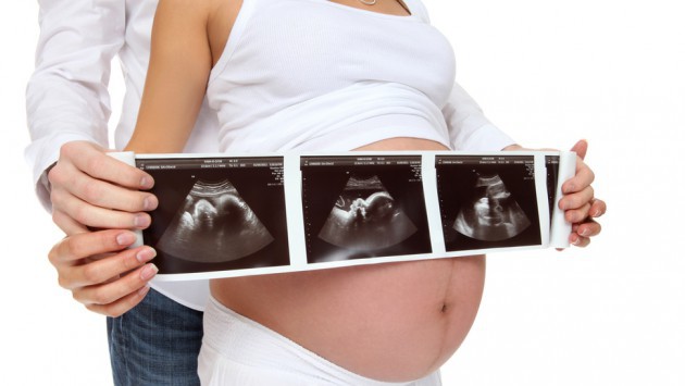  Что такое ЭКО беременность и как его делают?
