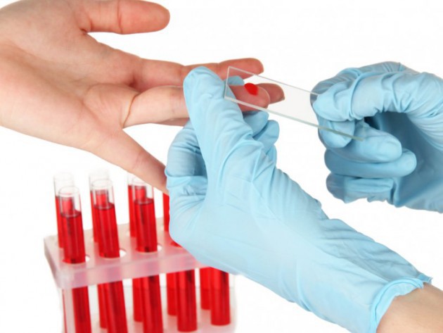 Детский общий анализ крови: разбираем "по полочкам"