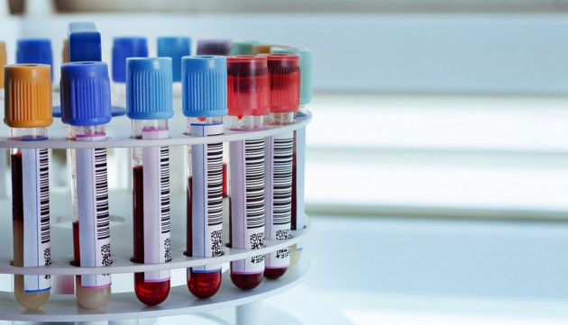 Определение гликозилированного гемоглобина в крови: суть методик