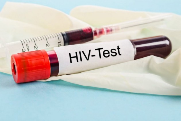 ПЦР и ИФА тестирование на ВИЧ-инфекцию