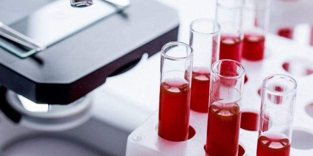 Методы исследования группы крови