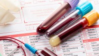 Показатели общего анализа крови на ранних сроках thumbnail