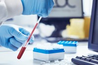 Методы определения гемоглобина в крови: какой подсчет практичнее?