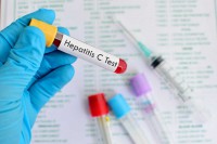 ПЦР или ИФА тестирование на гепатиты типов В и С  