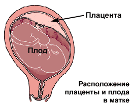 Расположение плаценты