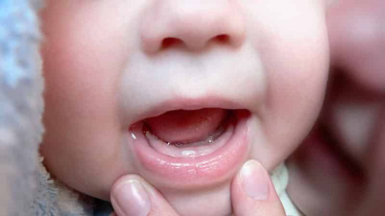 Сроки появления первых зубов