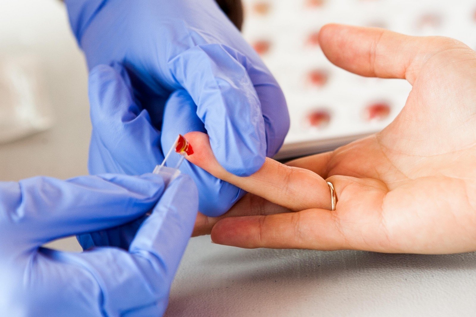 Анализ крови из пальца можно есть. Взятие крови из пальца. Взятие капиллярной крови из пальца. Взятие крови для анализа из пальца.