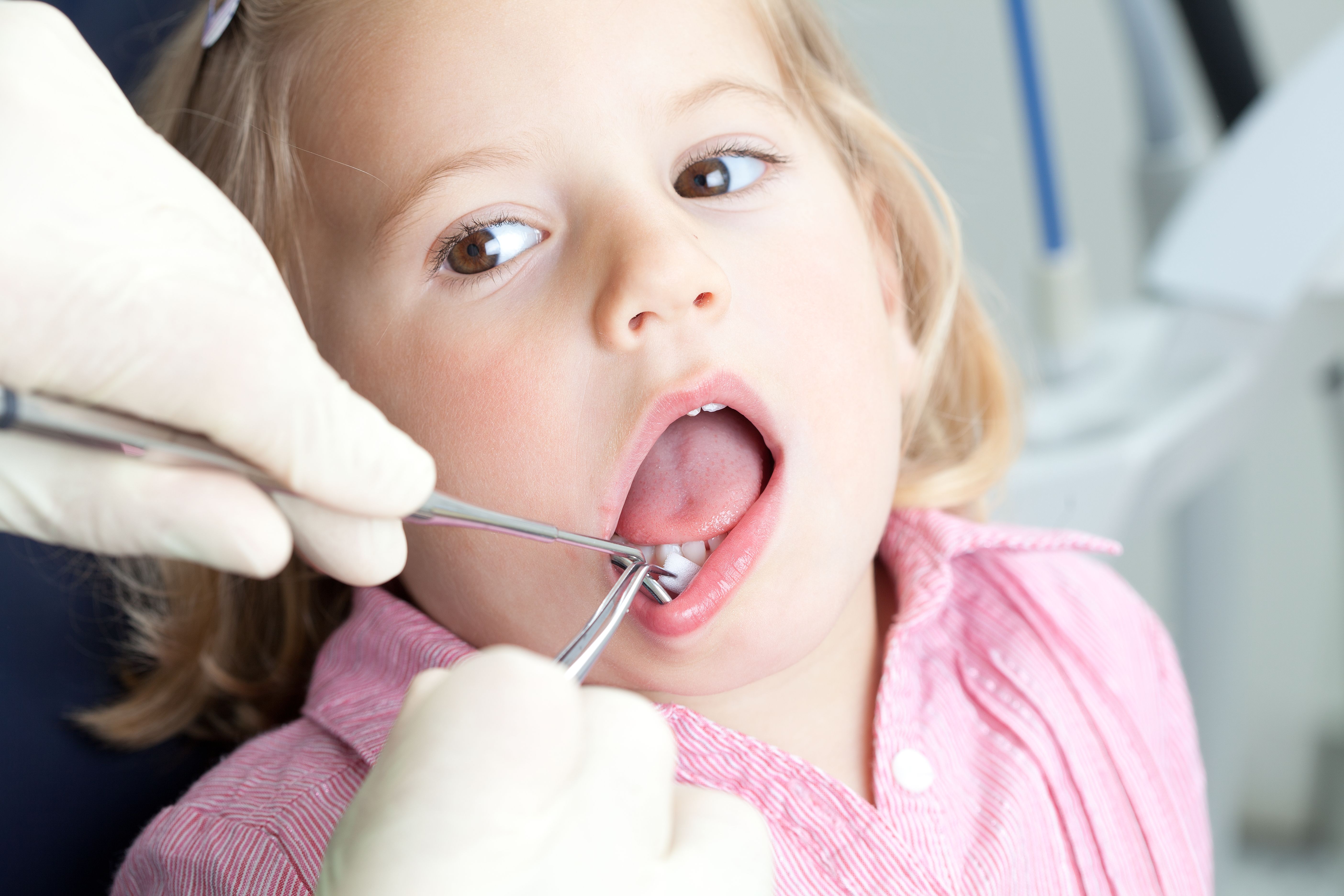 Осмотр полости рта детей. Пародонтит зуба у ребенка.