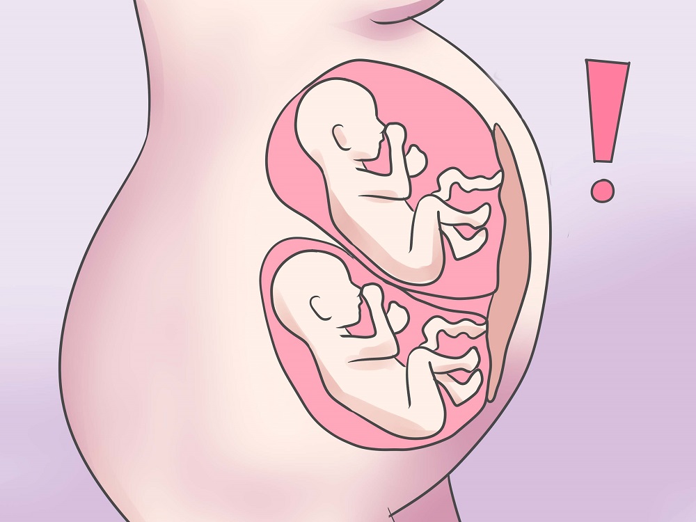 Многоплодная беременность и синдром фето фетальной трансфузии thumbnail